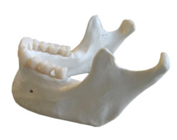 Mandibula ist die med. Bezeichnung für den menschlichen Unterkiefer (Knochen)